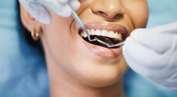 Best Walk-In Emergency Dentist in Milaca, MN